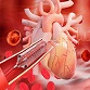 Indian-Made Supraflex Cruz Heart Stent Achieves Global Acclaim