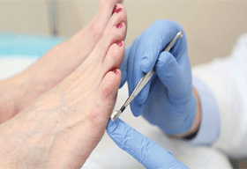 By Pradeep Moonot, Orthopaedic & Podiatric Surgeon (Foot & Ankle), Mumbai Knee Foot Ankle Clinic, Mumbai