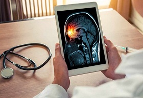 The Maharashtra government signs an agreement with a pharmaceutical company to use AI to improve stroke care in hospitals