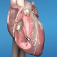 Abbott Launches Dual Chamber Leadless Pacemaker System