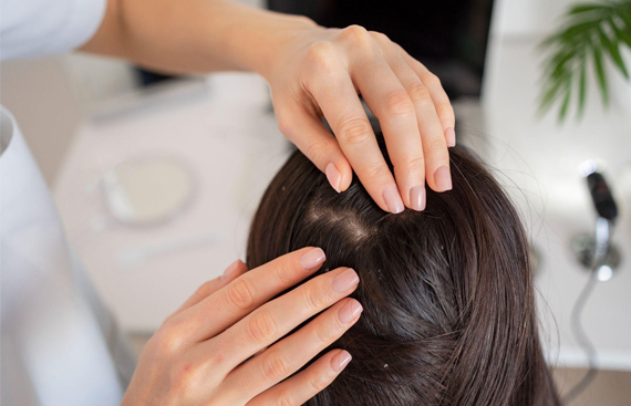 Gut Health and Dandruff: Decoding the Ultimate Connection