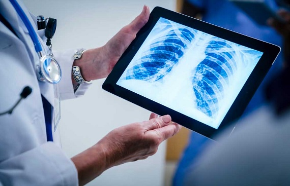 Indian startup DeepTek.ai Launches FDA-Cleared Chest X-Ray AI Solution