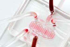 Gurgaon Hospital Launches Cutting-Edge Technology For Cancer Detection