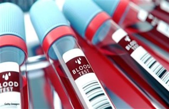 New blood test may help predict pre-term birth