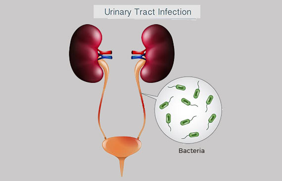 How To Prevent Urinary Tract Infections?