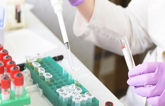 Molbio &UE LifeSciences Partner to Expand Painless Breast Cancer Screening