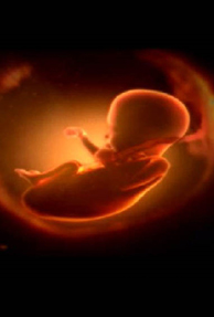 Indian women in U.S. aborting female foetuses?