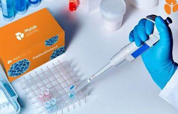 Mylab Discovery Solutions Launches Country's First COVID-19 Home Test Kit